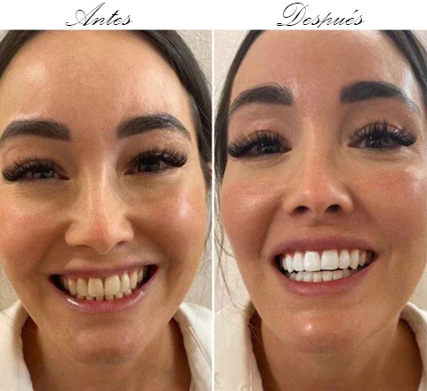 CREMA DENTAL BLANQUEADORA